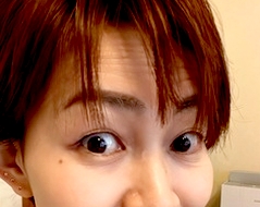 気になるおでこのしわ改善方法