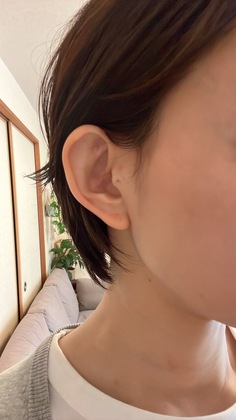 花粉症のつぼを刺激したら