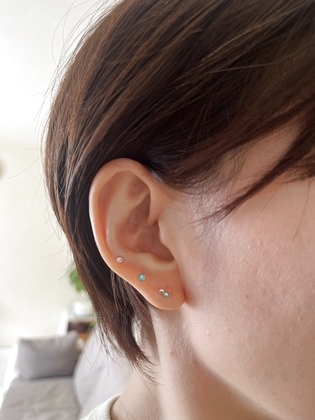 耳つぼシールは4～7日で外してください