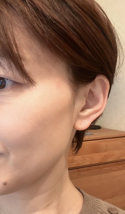 その首の凝り、食いしばりが原因？